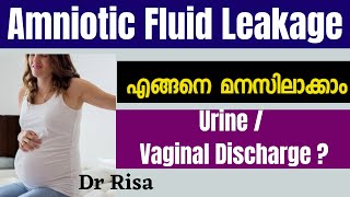 Amniotic Fluid leaking in pregnancy | Amniotic Fluid Vs Urine#shorts