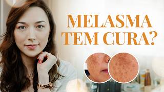 Is there a cure for melasma? I Understand how to care for your melasma