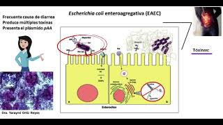 Escherichia coli enteroagregativa (EAEC) 🦠🧍‍♂️🧍‍♂️