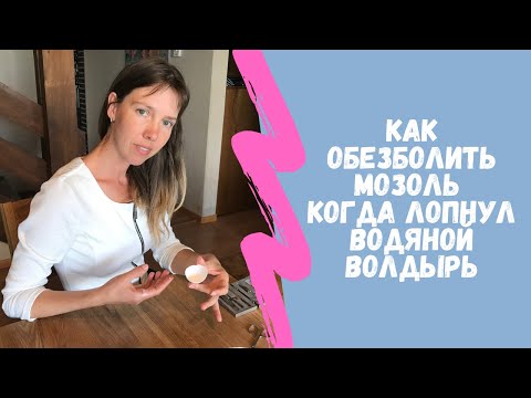 Как обезболить мозоль, когда лопнул водяной волдырь