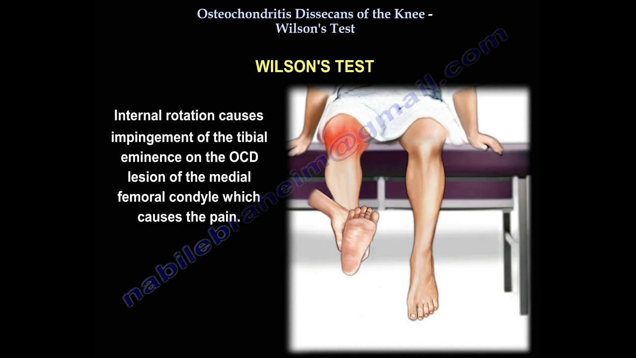 osteochondrosis artrosis kezelése a vállízületek deformáló osteoarthrosisának kezelése