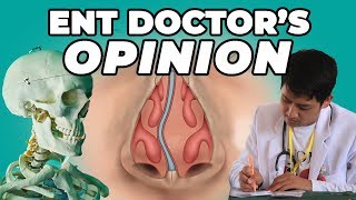 Can A Chiropractor Fix A Deviated Septum? | Mewing Update | ENT Doctor’s Opinion