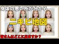 【SNSで話題】の「ニキビ地図」自分の身体の事が分かります！　SALONTube 渡邊義明