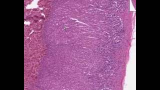 Shotgun Histology Adrenal