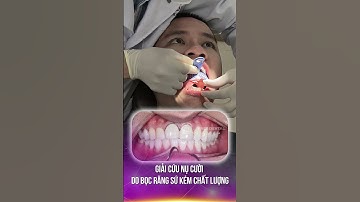 GIẢI CỨU NỤ CƯỜI DO BỌC RĂNG SỨ KÉM CHẤT LƯỢNG, SAI KHỚP CẮN, MÒN RĂNG, PHẦN 1