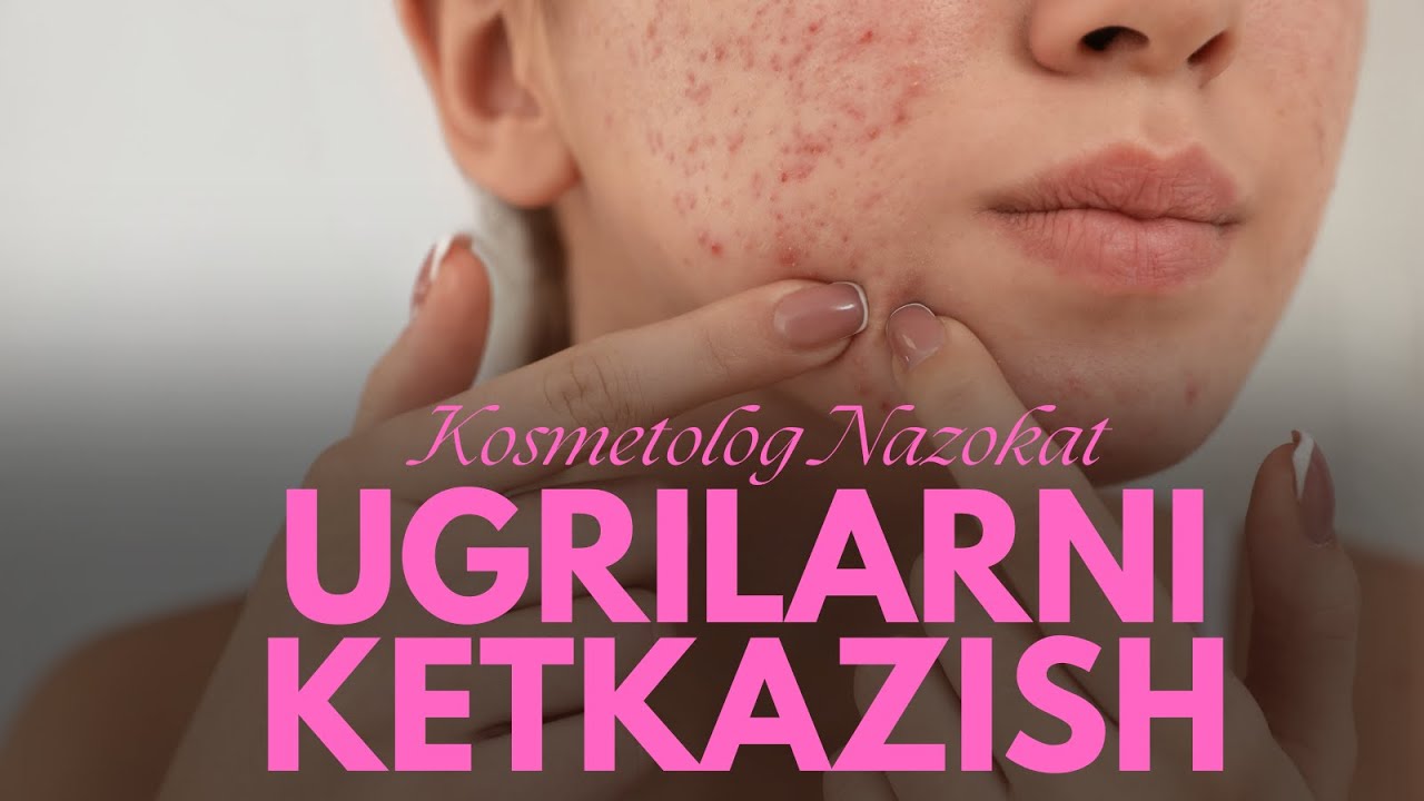 UGRILARNI KETKAZISH | KOSMETOLOG NAZOKAT