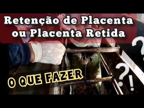 Vídeo: Como remover a placenta retida?