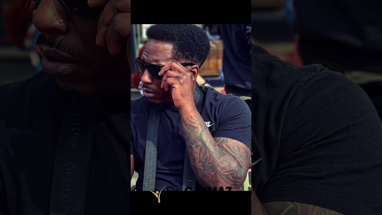 4500 Graft / 3 Years Result / Afro Hair Transplant by Dr Caymaz