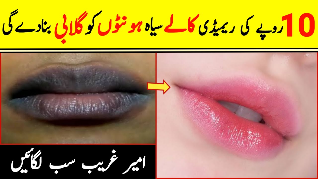 Black Lips To Pink Lips Permanently Kale Hoto Ko Pink Karne Ka Tarika
