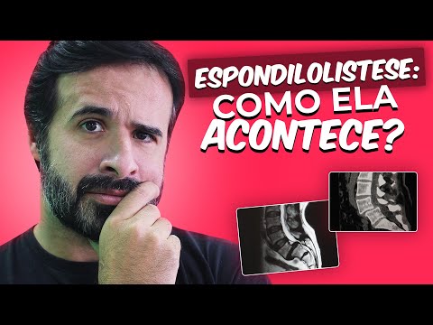 ESPONDILOLISTESE: COMO ELA ACONTECE?