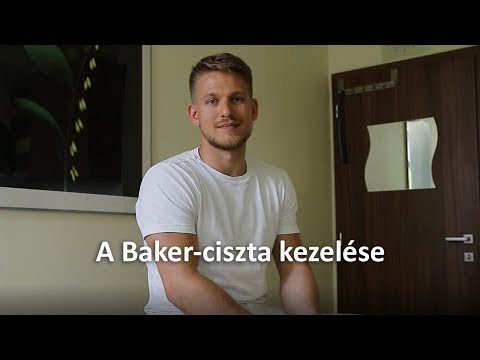 Videó: Coccyx Ciszta - Okok, Tünetek, Diagnózis, Kezelés, Rehabilitáció