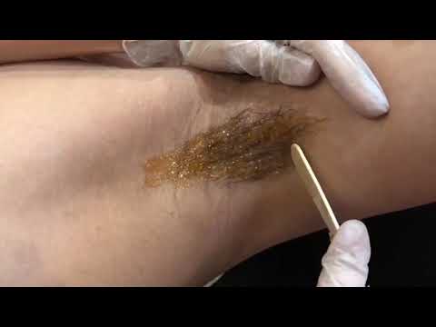 Underarm Waxing Tutorial(SACLAB Honeywax)