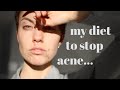 Explaining My Acne "Diet" | Day In The Life