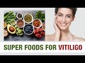 Super foods for vitiligo  aimil healthcare  dr nitika kohli