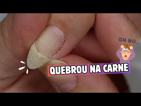 FIZ REMENDO COM BASE EM GEL NA MINHA UNHA