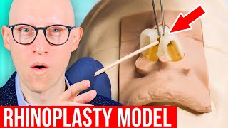 RHINOPLASTY Explained by Plastic Surgeon