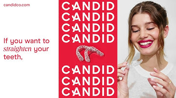 Candid Looping Video Horizontal v1