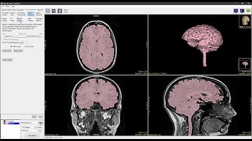 Analyze 14.0 - Segment: Morph Objects
