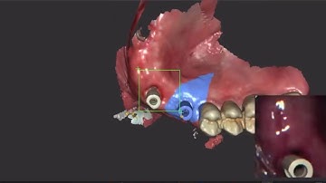 CS 3600/CS 3700 Locking Feature For Multiple Scan Bodies