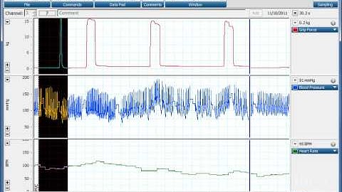 Using Comments in LabChart
