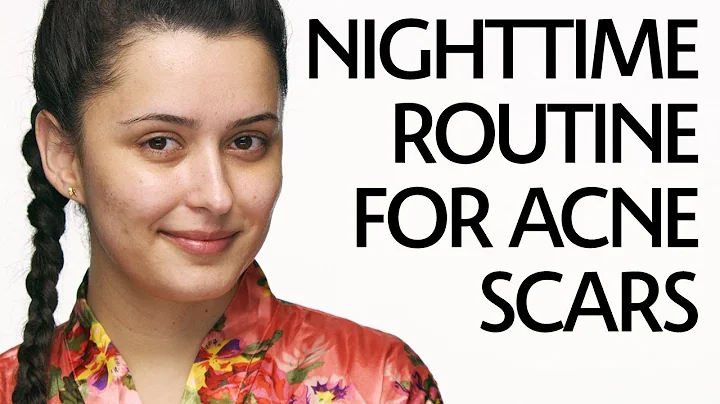 Get Unready With Me: Nighttime Routine for Acne Scars | Sephora
