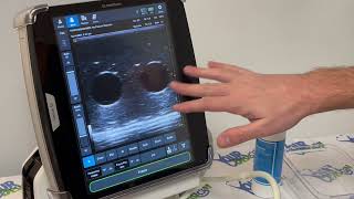 Information DVT 2021 Your Design Medical Update