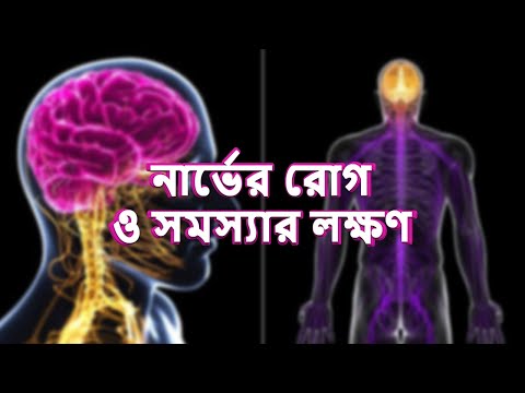 ভিডিও: আপনার পিঠে একটি চাপা নার্ভ নির্ণয় এবং চিকিত্সার সহজ উপায়