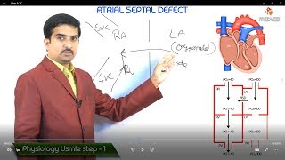 Atrial Septal Defect (ASD) USMLE Step 1  Pathophysiology