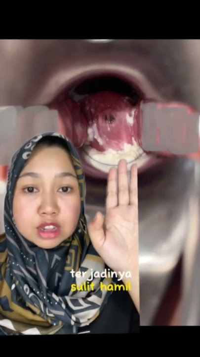 keputihan abnormal 1 #bidanzulfa #bidankebayoranlama #bidanjakartaselatan #edukasikesehatan