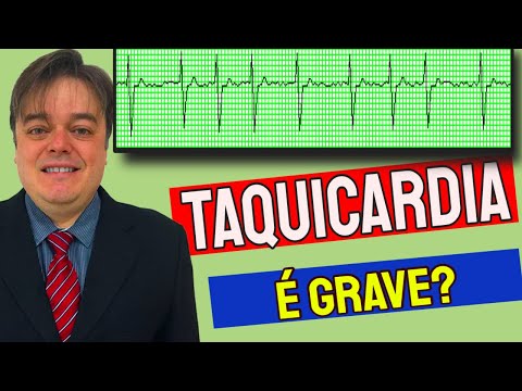 Vídeo: Taquicardia - Causas, Tipos, Sintomas, Diagnóstico, Tratamento