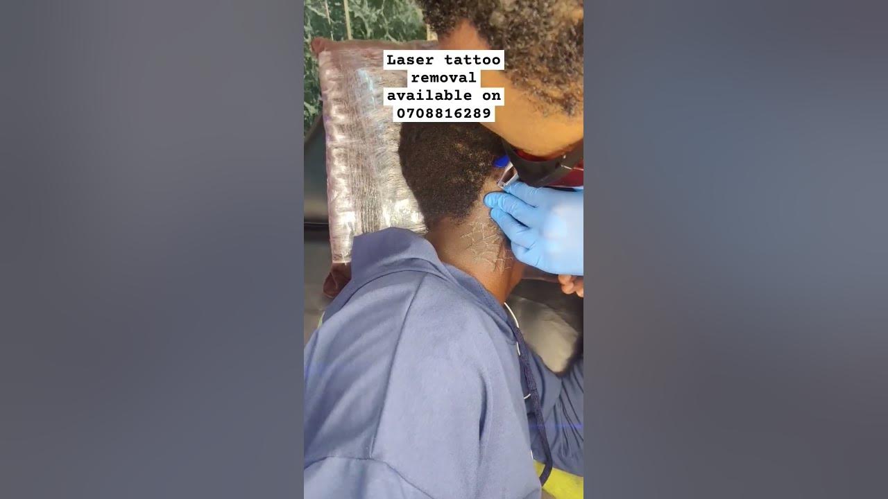 Tattoo Removal In Nairobi kenya tattooremoval YouTube tattoo-removal-in-nairobi-kenya-tattooremoval-youtube