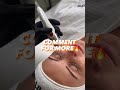 Zemits CrystalFrax - Лікування Anti-Age нового рівня: чудові результати без голок, без болю 🔥