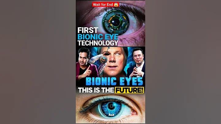 Elon Musk's BIONIC EYES is Here | Computer Chip Inside Eyes😱 trending shorts 🫣#shorts  #technology