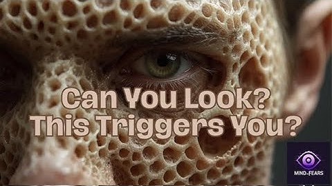 Trypophobia – Fear of Small Holes🧠 “Why Some People Fear Tiny Holes 😨| Mind_Fears