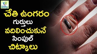 how To Get Rid of Ring Mark on Finger - Mana Arogyam Telugu Health Tips