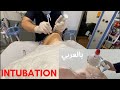 (التنبيب الرغامي )  Endotracheal Intubation Arabic