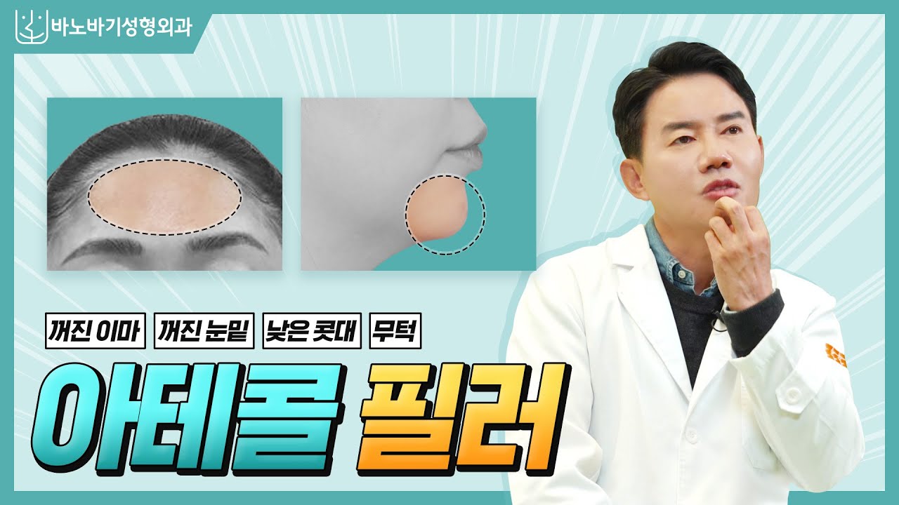 🔺아테콜 필러🔺 전국에 아테콜이 공급되는 검증된 병원은 오직 7곳뿐이다??? feat. 아테콜 14년 차 #반재상 #아테콜 #바노바기 [아테콜필러][반영구필러]