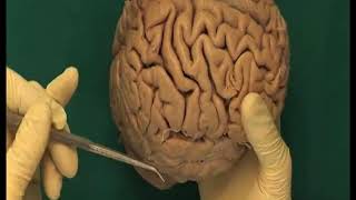 Différence entre sulcus et fissure