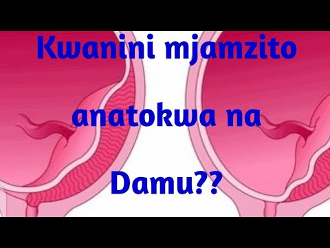 Video: Ni Nini Kinachoweza Kupikwa Kutoka Kwenye Kitambaa Cha Lax