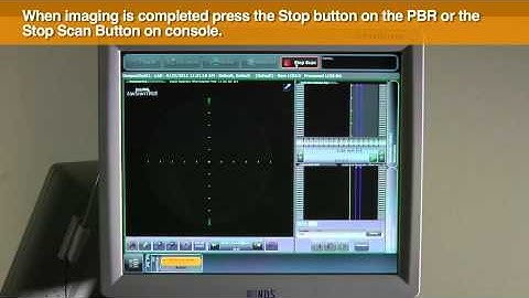 Demonstration of How to Initiate a Scan on the TVC Imaging System