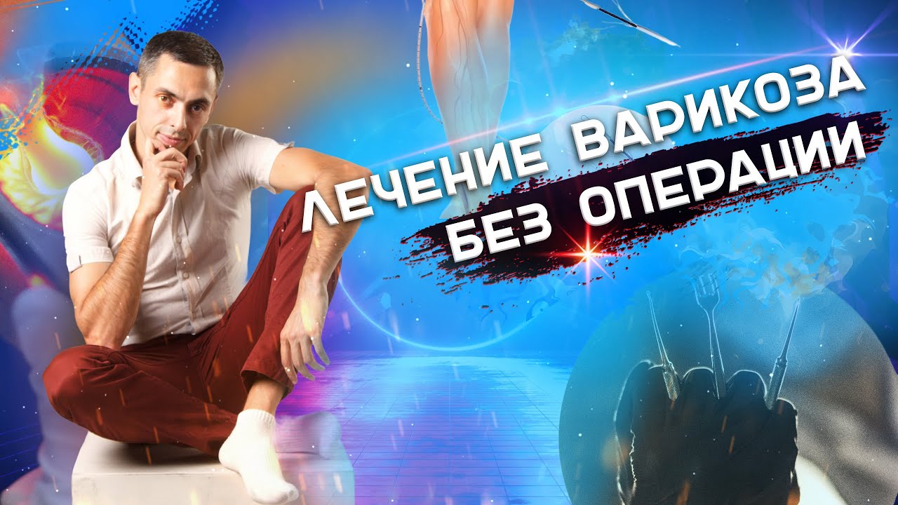 Лечение варикоза без операции. #лечениеварикоза #варикоз - YouTube