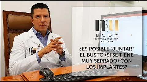 ¿Puedo juntar más los implantes?