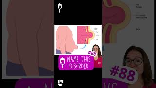✍️Name this disorder 88: Medical Surgical SHORT | @LevelUpRN