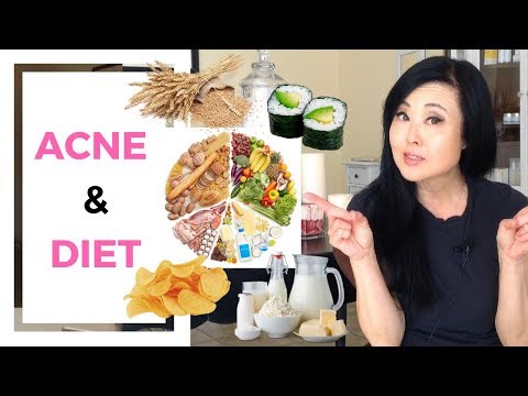 ACNE AND DIET