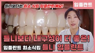임플란트 틀니 가격과 임상 소개