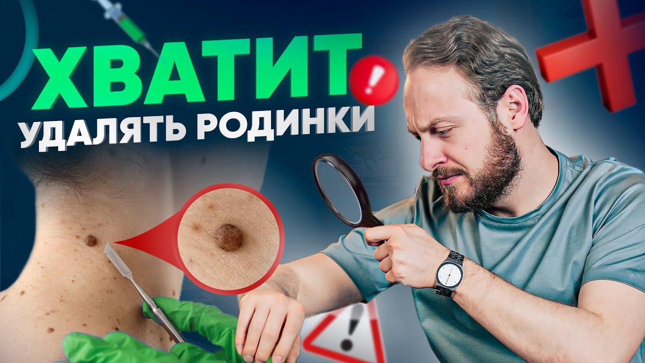 Родинки и онкология – есть ли связь? Ответ тебя удивит - YouTube