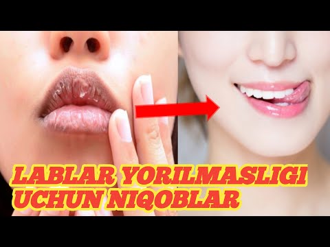 Video: Dudoqlar qurib qolishini oldini olishning 3 usuli