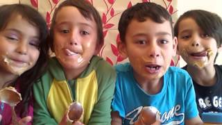 Treeman Sticky Chin Challenge Part 2