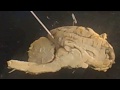 Brain Anatomy and Functions Quiz