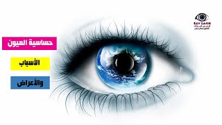 حساسية  العيون | الأسباب والأعراض | أفضل طرق العلاج